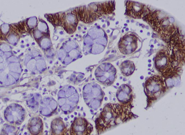 New Research on IBD from ISB’s Family Genomics Group
